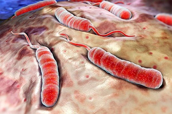 Особо опасные инфекционные заболевания холера чума оспа thumbnail